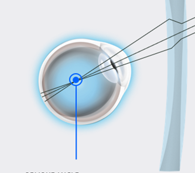 Lens Design – Noon Shop